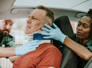 Head Injuries from Car Accidents